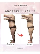 アローナ(ARONA)/結果にコミット痩身！