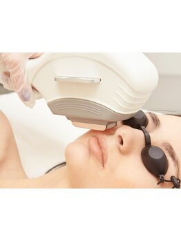 顔脱毛がしたい