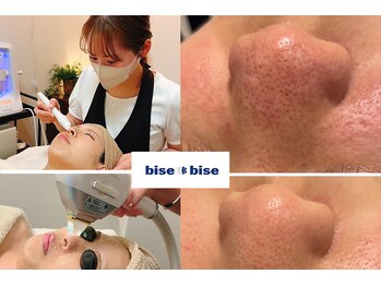 ビズビズ 梅田店(bisebise)の写真/角栓毛穴開き解消！毛穴ハイドラ×肌育フォトでつるんとした韓国女優のような毛穴レス肌を目指しませんか？
