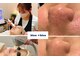 ビズビズ 梅田店(bisebise)の写真/角栓毛穴開き解消！毛穴ハイドラ×肌育フォトでつるんとした韓国女優のような毛穴レス肌を目指しませんか？