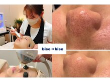 ビズビズ 梅田店(bisebise)