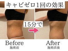 エトワール(etoile)の雰囲気（キャビゼロ1回でこの効果!EMSとW効果で脂肪燃焼×引き締め2倍!!）