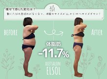 エルソル(elsol)