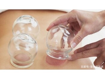 楽楽整体サロン/吸い玉コース