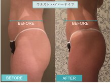 プライマルビューティ 艶 本店(Primal Beauty)/本気の痩身！ADEで痩せよう！