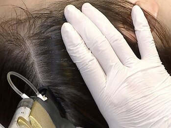 エステティックサロン リノリノ(Lino Lino)の写真/【養毛スカルプ/美髪/白髪予防】皮膚理論から生まれたリアボーテAC幹細胞ジェット導入+ヘッドスパ45分¥9240