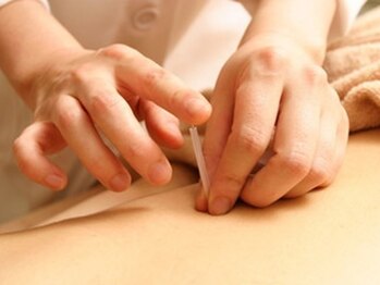 晴海一水鍼灸院の写真/マッサージだけではなかなか改善しなかった身体の不調もお任せください！歴25年以上の鍼灸師がお悩み改善◎