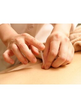 鍼灸施術を受けたい