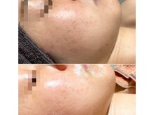 オーシャンブルーム 目黒(OceanBloom)/