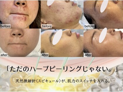 プリュボーテ(Pul Beaute)の写真