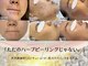 プリュボーテ(Pul Beaute)の写真