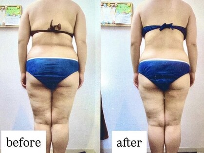 アイビー(Aivy)の写真