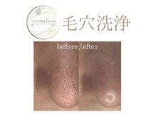 エミング(yeming)