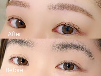 フォルミー(forume)の写真