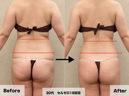 ドルチェエフェクト(dolce effect)の写真