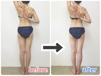 ルビーズ 柏店(RUBYZ)/リンパのつまり度をチェック