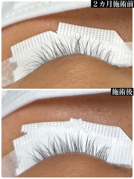 ブレスヘアー アイラッシュ(Breath hair eyelash)/まつ毛美容液ケア