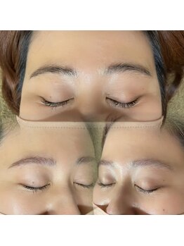 ムーンアイビューティープラス(moon eye beauty+)/間引き(眉)