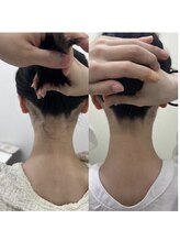 ミース 江坂店/うなじ●ビフォーアフター