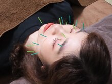 ラクシア(Rakushia)の雰囲気(フェイスラインのたるみ、眼精疲労のお悩みには美容ばり!)