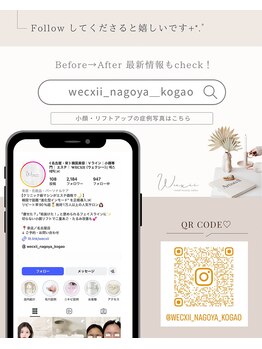 ウェクシー 名古屋駅前店(WECXII)/Instagram 小顔・リフトアップ