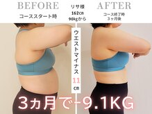 スリービーダイエット 町田店/ダイエットビフォーアフター