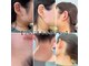 カロス(Calos)の写真