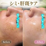 ココスタイルビューティー(COCOSTYLE beauty)