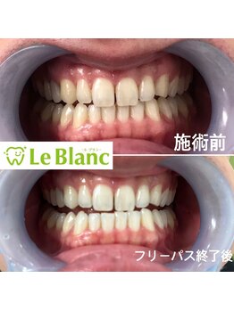 ルブラン 奈良店(Le Blanc)/白さでお返し致します!