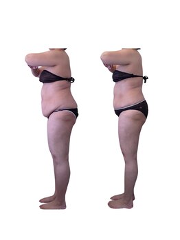 ヴィアス(VIAS)/セルゼロ6回の効果！