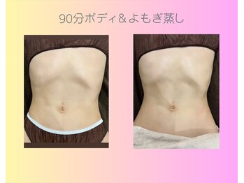 エスナ/【よもぎ蒸しで相乗効果】