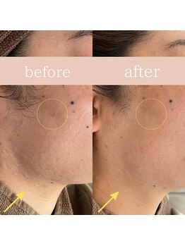 ハナワビューティーサロン(HanaWa beauty salon)/before&after