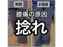 カワル整体 上通り院/膝が痛む人