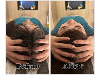 整体ラルース 中目黒(LALUZ)/30代 女性 小顔ヘッドスパ 変化