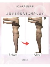 アローナ(ARONA)/美BODYを叶えるならコレ！