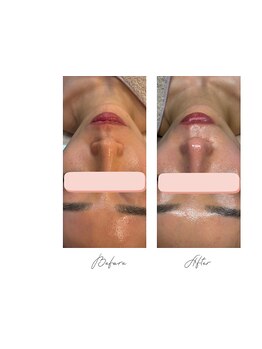 お肌をきれいにしたい