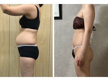 スリーピングビューティー(Sleeping Beauty)/