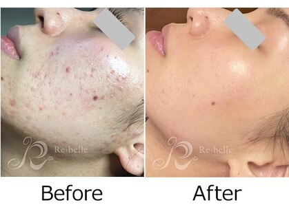 アトリエリン(Atelier Rin)の写真