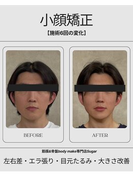 シュガー 津市(Sugar)/BeforeAfter【小顔矯正】