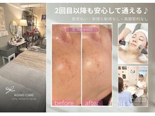 ペルラペティーユ(PERLA PETILLER)