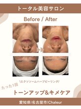 シャルール プラス(Chaleur+)/