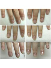 コットンローズ(Cotton Rose)/深爪ケア