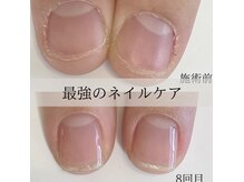 ジェルを使わずたった3ヶ月で美爪育成する最強のネイルケア★