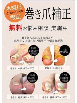 美 アンジュ(美 ange)/巻き爪補正