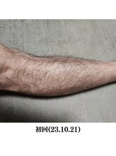 レイ(R.E.I)/【脱毛ビフォー】すね部