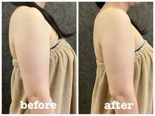 ビュップ 海老名店(美up)/【グロッティボディ】