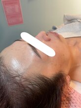 シレニータ ワックス(SIRENITA WAX)/カーボキシー高濃度炭酸パック♪