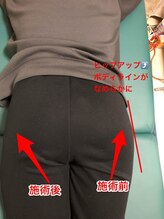 哲心 姫路/外張り・前張りが減りました