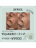新メニュー！！【SNSで話題沸騰中！】WiQo水光ピーリング　￥9,900