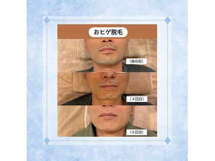 テトテ(tetote)の写真